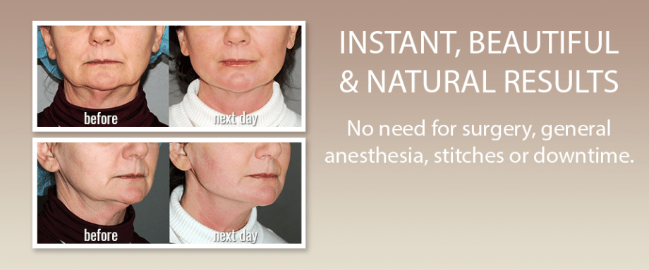 Saggy Jowls Treatment