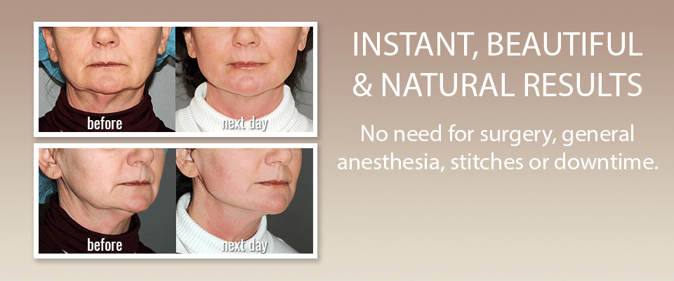 Saggy Jowls Treatment