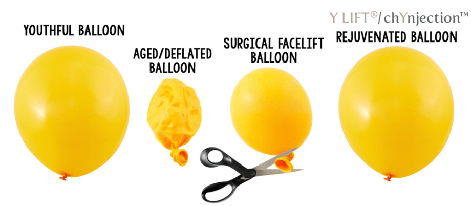 Saggy-Jowls-Balloon-Analogy-v2
