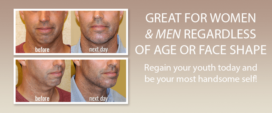 Saggy Jowls Treatment for Men