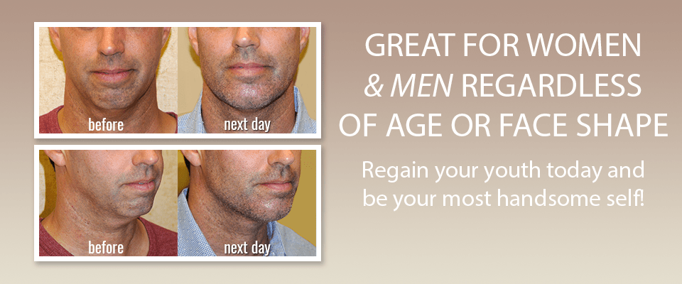 Saggy Jowls Treatment for Men